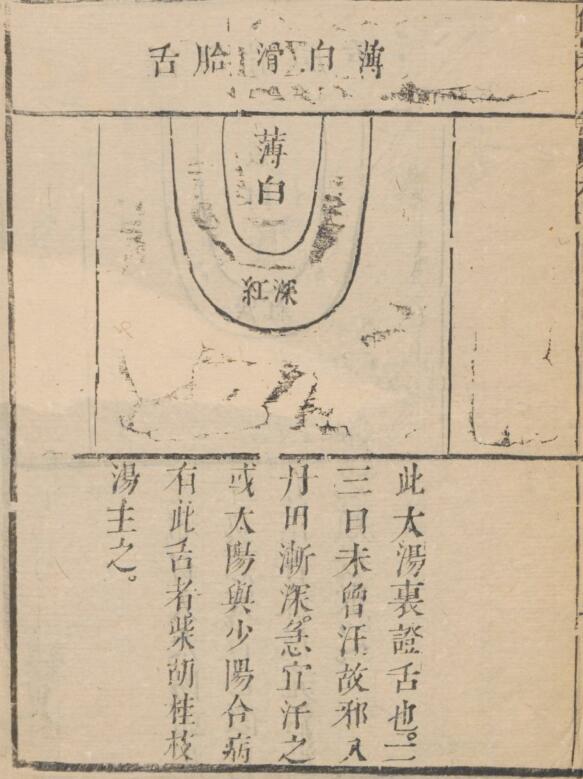 伤寒舌鉴 1 卷
